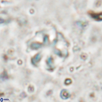 Olladiscoaster asterilithos 29581