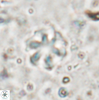 Olladiscoaster asterilithos 29581