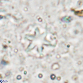 Olladiscoaster asterilithos 29582