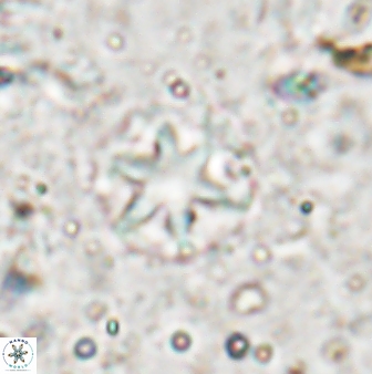 Olladiscoaster asterilithos 29582