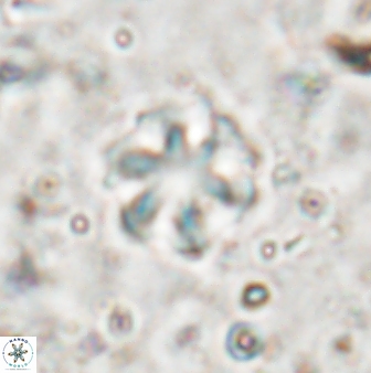 Olladiscoaster asterilithos 29583