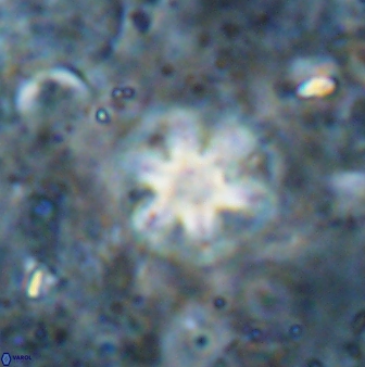 Olladiscoaster asterilithos 29584