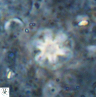 Olladiscoaster asterilithos 29584