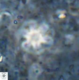 Olladiscoaster asterilithos 29585
