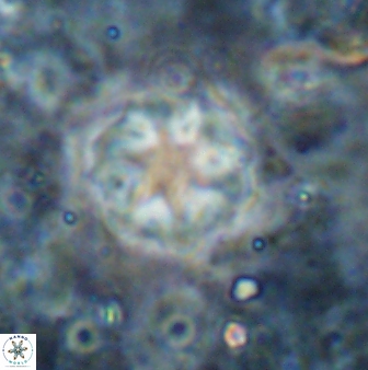Olladiscoaster asterilithos 29587