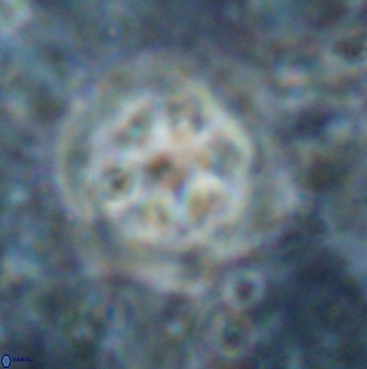 Olladiscoaster asterilithos 29588