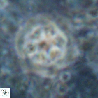 Olladiscoaster asterilithos 29588