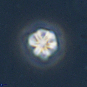 Olladiscoaster bordii 31458