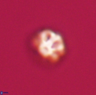 Olladiscoaster bordii 31464