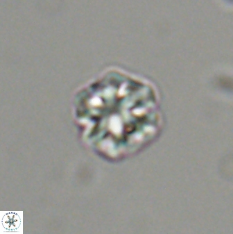 Olladiscoaster bordii 31474