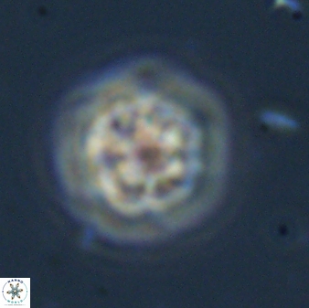 Olladiscoaster bordii 31480