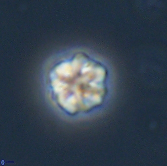 Olladiscoaster bordii 31481