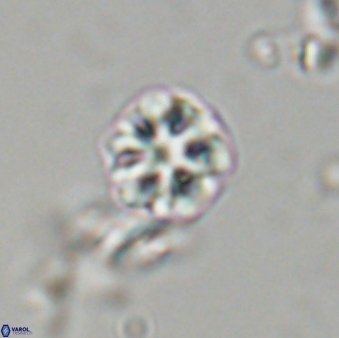 Olladiscoaster bordii 31492