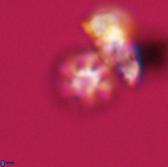 Olladiscoaster bordii 31502