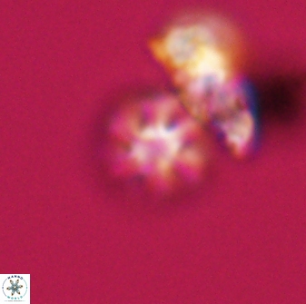 Olladiscoaster bordii 31502