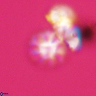 Olladiscoaster bordii 31504