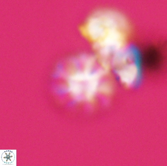 Olladiscoaster bordii 31504