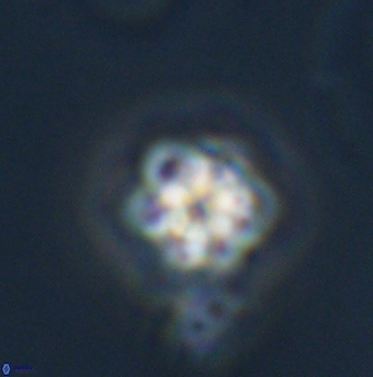 Olladiscoaster bordii 31515