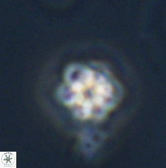 Olladiscoaster bordii 31515