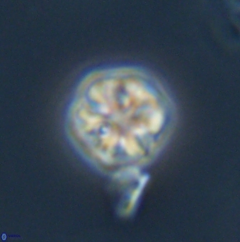 Olladiscoaster bordii 31516