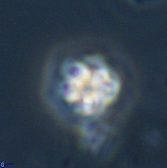 Olladiscoaster bordii 31519