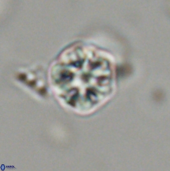Olladiscoaster bordii 31524