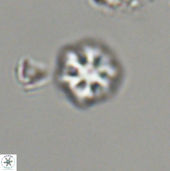 Olladiscoaster bordii 31528
