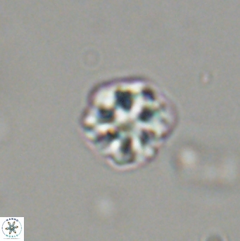 Olladiscoaster bordii 31537