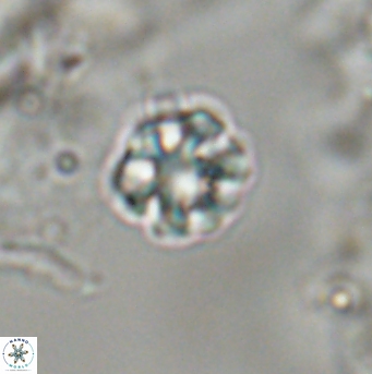 Olladiscoaster bordii 31541