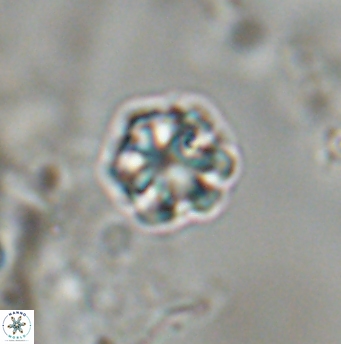 Olladiscoaster bordii 31546
