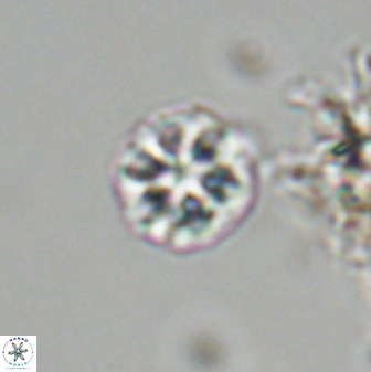 Olladiscoaster bordii 31245
