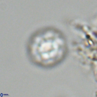 Olladiscoaster bordii 31246