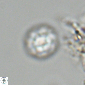 Olladiscoaster bordii 31246
