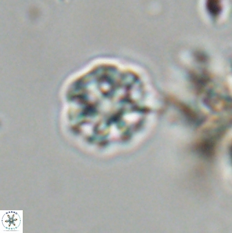 Olladiscoaster bordii 31252
