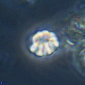 Olladiscoaster bordii 31253