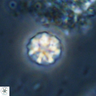 Olladiscoaster bordii 31258