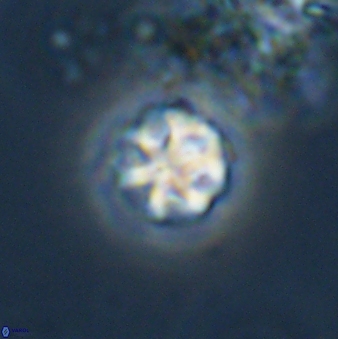 Olladiscoaster bordii 31261