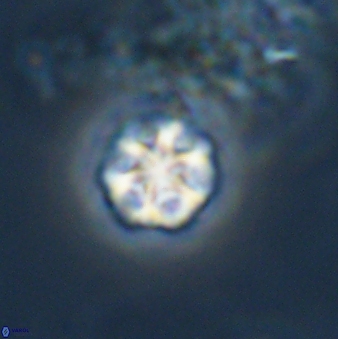 Olladiscoaster bordii 31264