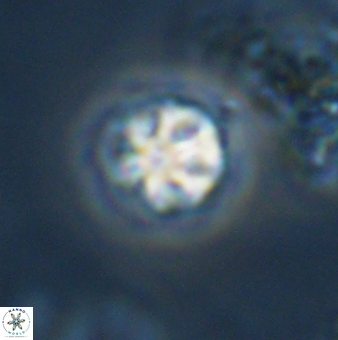 Olladiscoaster bordii 31267