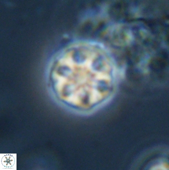 Olladiscoaster bordii 31269