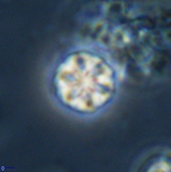 Olladiscoaster bordii 31270