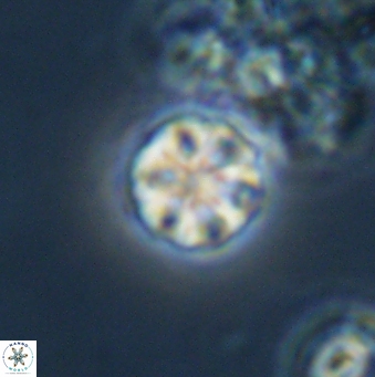 Olladiscoaster bordii 31272