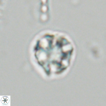 Olladiscoaster bordii 31285