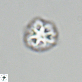 Olladiscoaster bordii 31286
