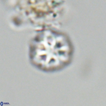 Olladiscoaster bordii 31291