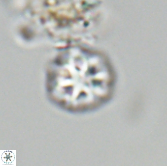 Olladiscoaster bordii 31291