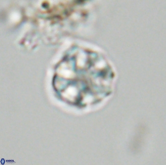 Olladiscoaster bordii 31292