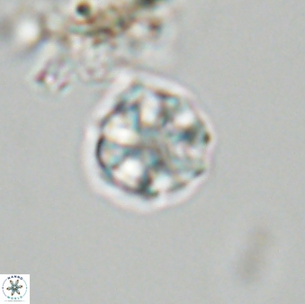Olladiscoaster bordii 31292