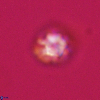 Olladiscoaster bordii 31313