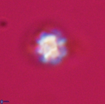 Olladiscoaster bordii 31317